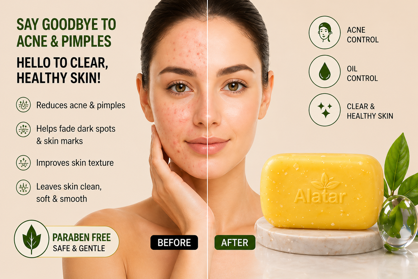 Alatar 10% Sulphur Anti-Acne Soap – Oil Control & Clear Skin