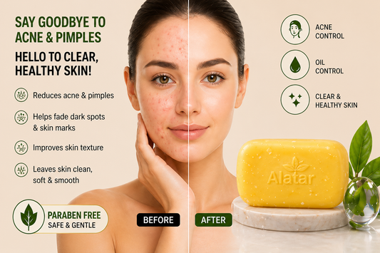 Alatar 10% Sulphur Anti-Acne Soap – Oil Control & Clear Skin